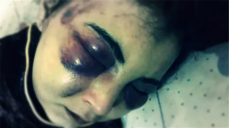 عذب زوجته بوحشية بسبب «فيس بوك»